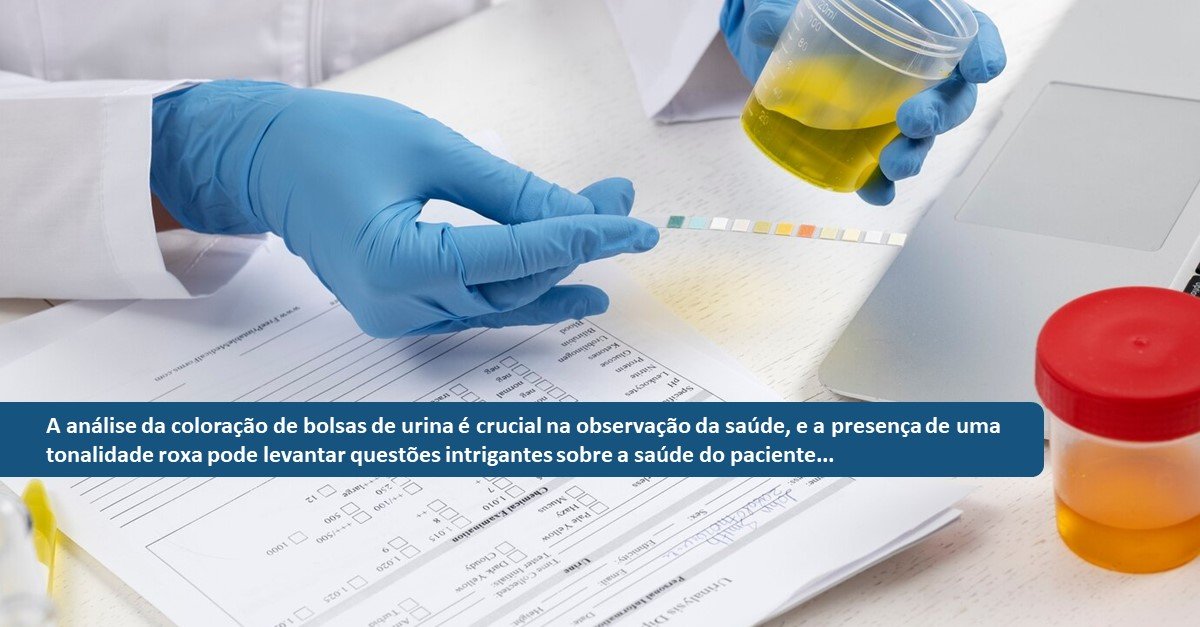 Bolsa de Urina Roxa: Quais as possíveis causas, e teste de coloração de Gram